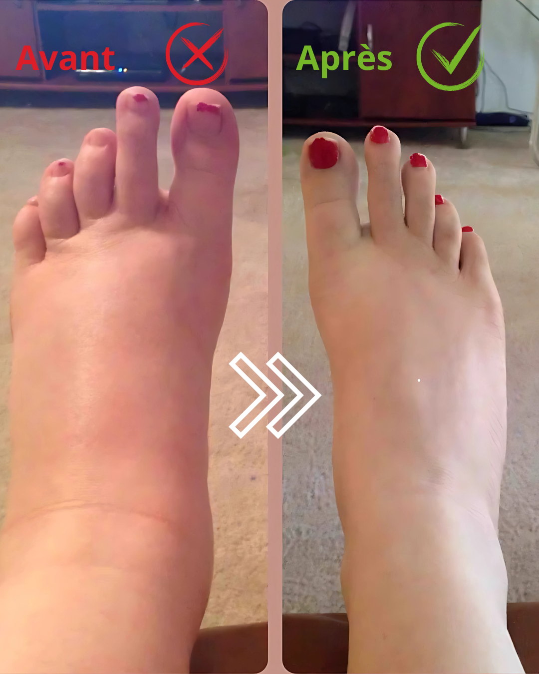 Lotion Nervrolaxe – Soulagement des douleurs nerveuses et Musculaire
