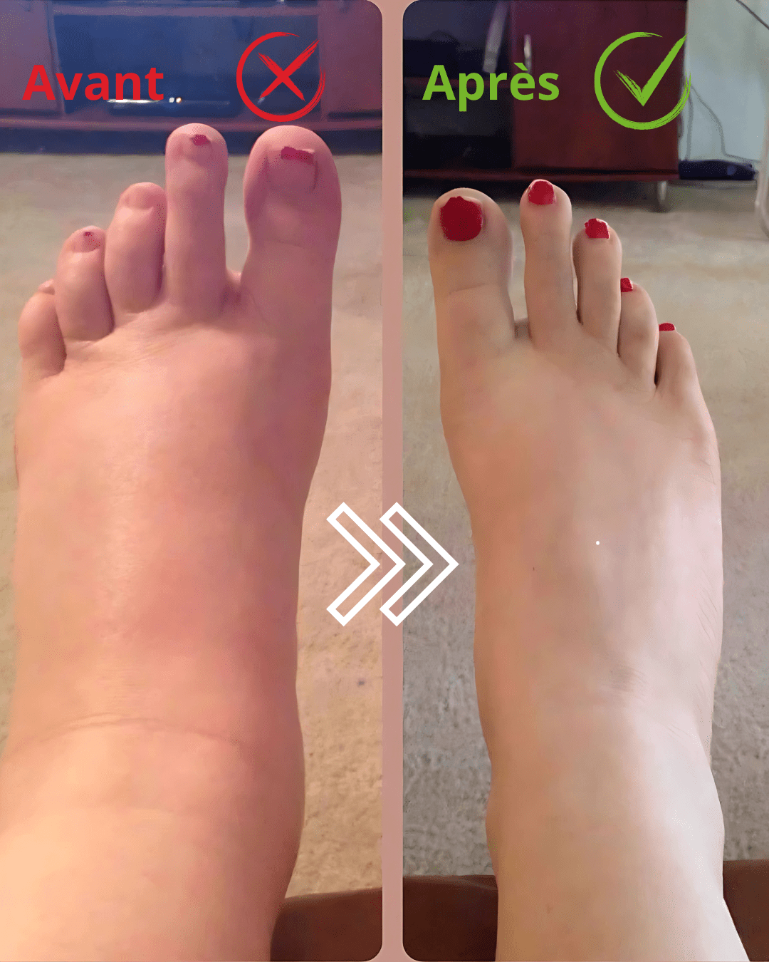 Lotion Nervrolaxe – Soulagement des douleurs nerveuses  et Musculaire